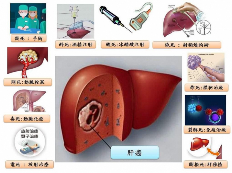 全球第六大常見癌症的肝癌，死亡率高居國人第二名。（照片林敬斌主任提供）