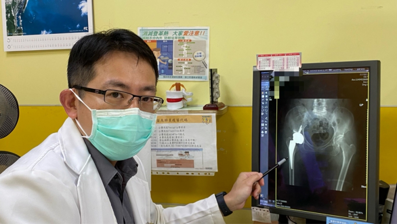 腰痛20年，員榮陳建甫主任開刀置換人工髖關節解決。（照片員榮提供）