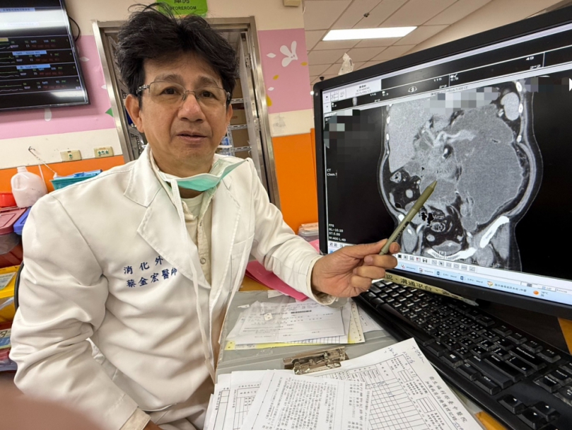 胰臟炎合併十二指腸穿孔 醫護細心陪他闖關成功 歡慶52歲生日新人生