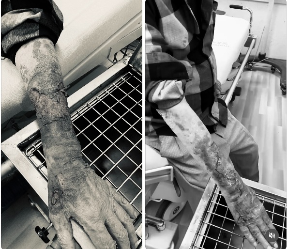 老翁被陳姓男子毆打成傷 警傳喚陳男到案訊後送辦