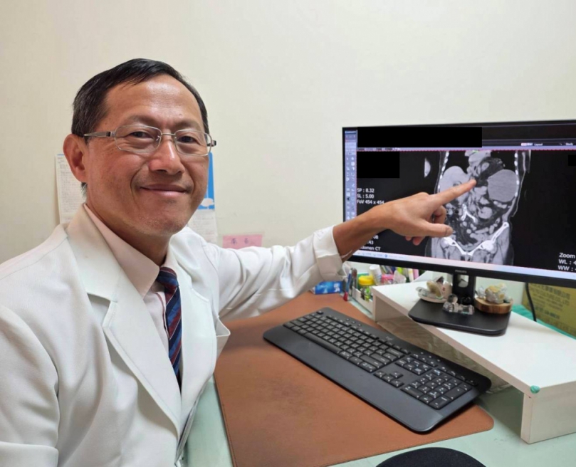 八旬嬤每吃必吐 竟是腸子「離家出走」 釀罕見自發性橫膈膜疝氣