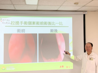 57歲企業主頻尿解尿困難　「攝護腺無傷口拉提手術」10分鐘重拾順暢人生