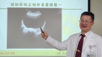出國前卵巢扭轉腹痛掛急診　緊急手術切除囊腫保卵巢